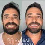dentista 24h Mairake