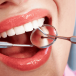 Lentes de contato dental em Ribeirão Preto com atendimento 24h? A Mairake Odontologia oferece estética de alto nível e suporte completo para transformar seu sorriso.